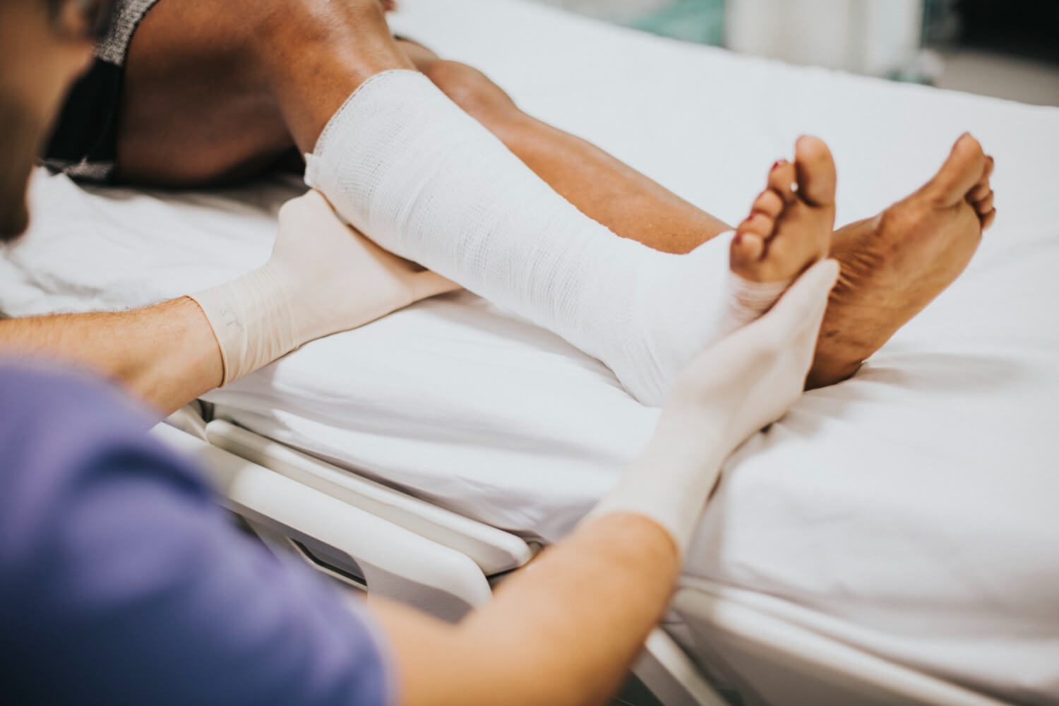 doctor helping patient with fractured leg - Orthopedic